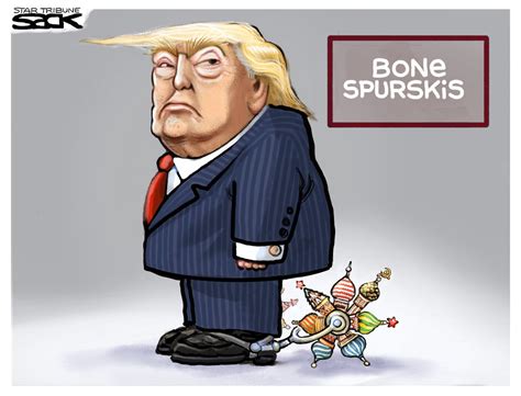 are trumps bone spurs fake